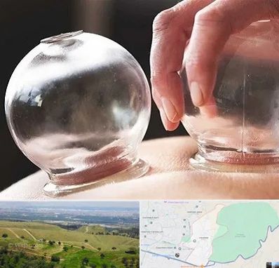 مرکز حجامت در سوهانک