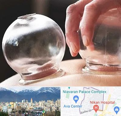 مرکز حجامت در آجودانیه