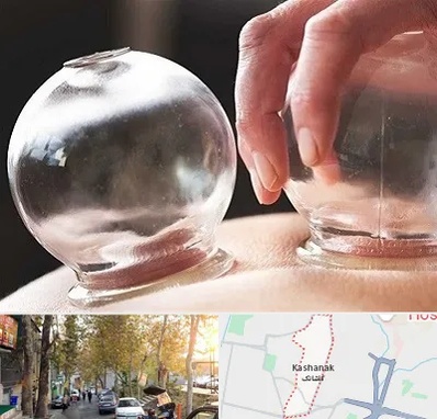 مرکز حجامت در کاشانک