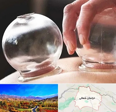 مرکز حجامت در خراسان شمالی