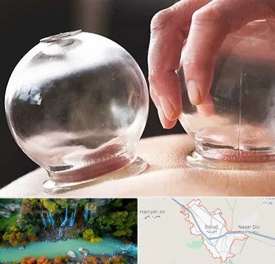 مرکز حجامت در دورود