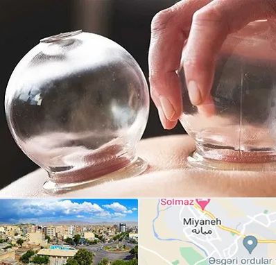 مرکز حجامت در میانه