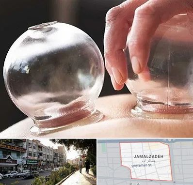 مرکز حجامت در خیابان جمالزاده