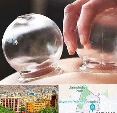 مرکز حجامت در نیاوران 