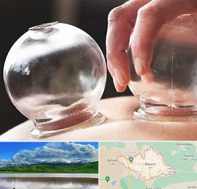 مرکز حجامت در مرند