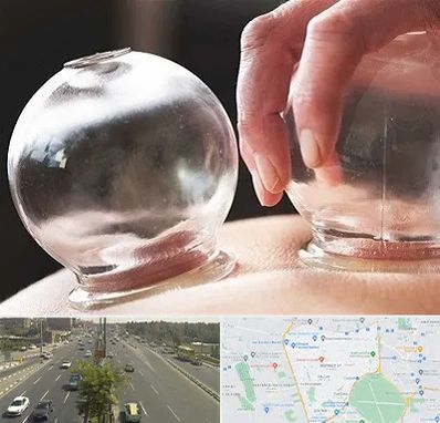 مرکز حجامت در منطقه 17 تهران