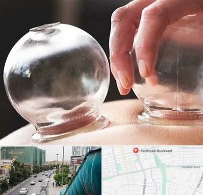 مرکز حجامت در بلوار فرحزادی