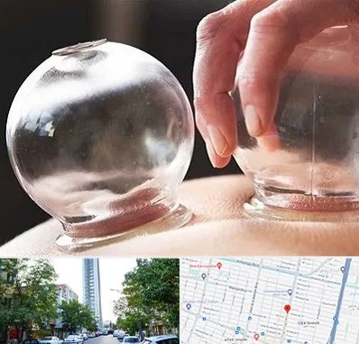 مرکز حجامت در امامت مشهد