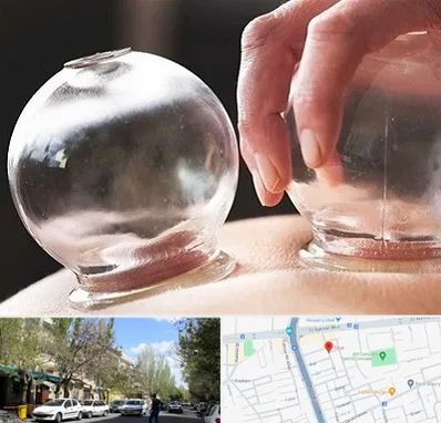 مرکز حجامت در کوی فیروز تبریز