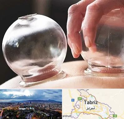 مرکز حجامت در تبریز