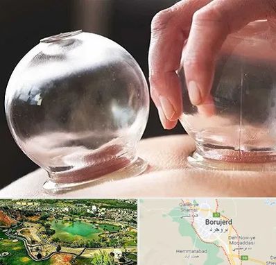 مرکز حجامت در بروجرد