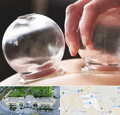 مرکز حجامت در نسیم شهر