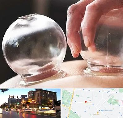 مرکز حجامت در بلوار سجاد مشهد