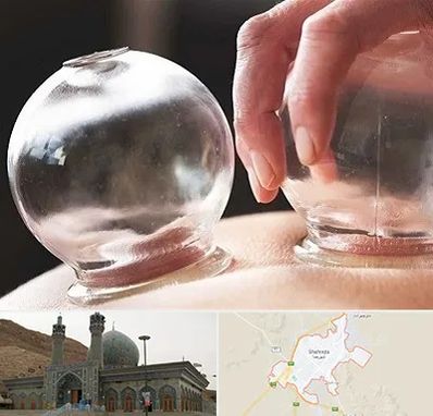 مرکز حجامت در شهرضا