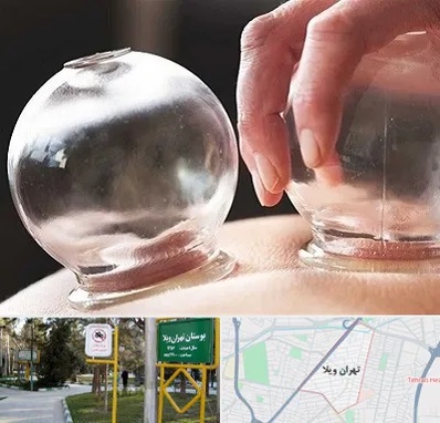 مرکز حجامت در تهران ویلا