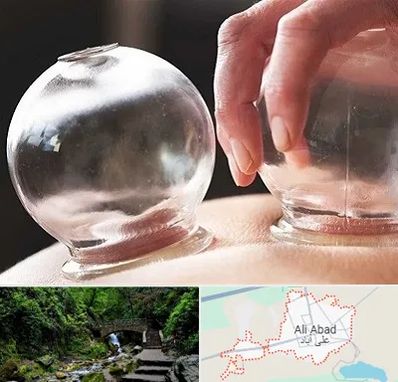 مرکز حجامت در علی‌ آباد کتول