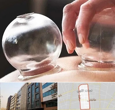 مرکز حجامت در نجات اللهی
