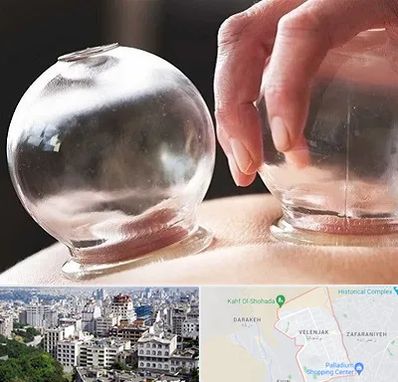 مرکز حجامت در ولنجک 