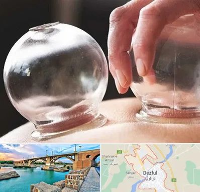 مرکز حجامت در دزفول