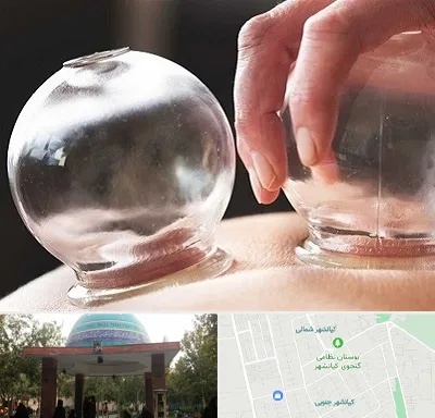 مرکز حجامت در کیانشهر