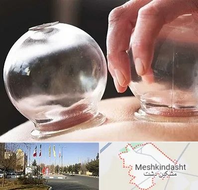 مرکز حجامت در مشکین دشت