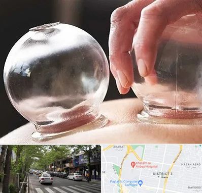 مرکز حجامت در ظفر 