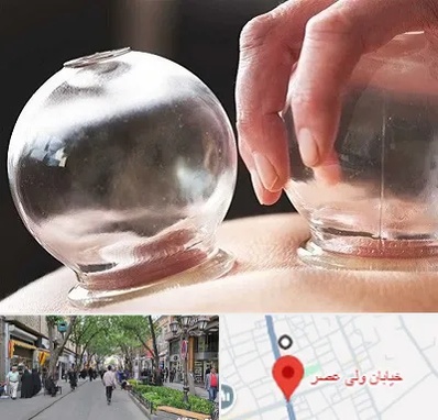 مرکز حجامت در ولیعصر شهریار