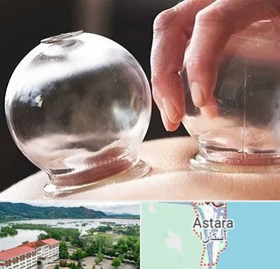 مرکز حجامت در آستارا
