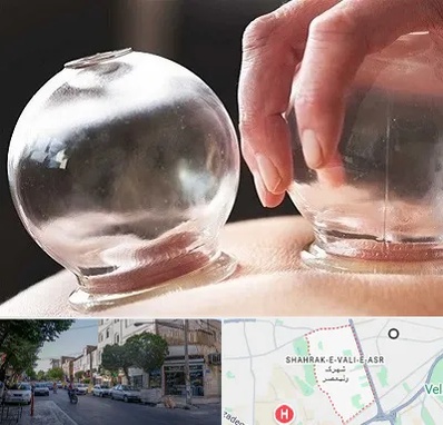 مرکز حجامت در شهرک ولیعصر