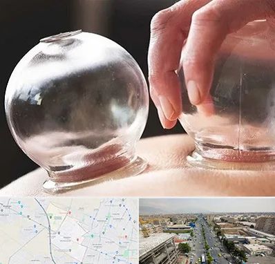 مرکز حجامت در حصارک کرج