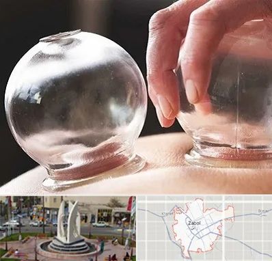 مرکز حجامت در زابل