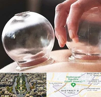 مرکز حجامت در نارمک 