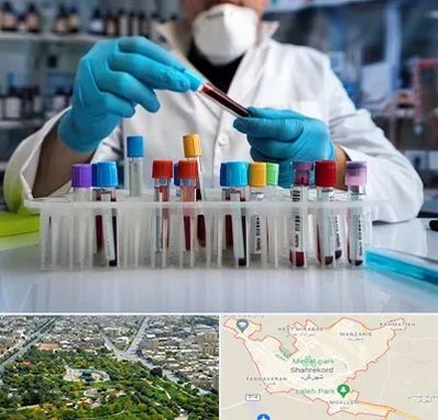 آزمایشگاه خون در شهرکرد