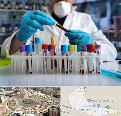 آزمایشگاه خون در پرند