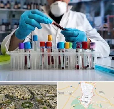 آزمایشگاه خون در قزوین