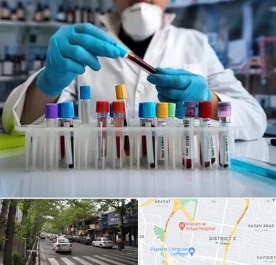 آزمایشگاه خون در ظفر