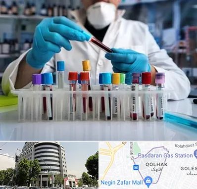 آزمایشگاه خون در قلهک