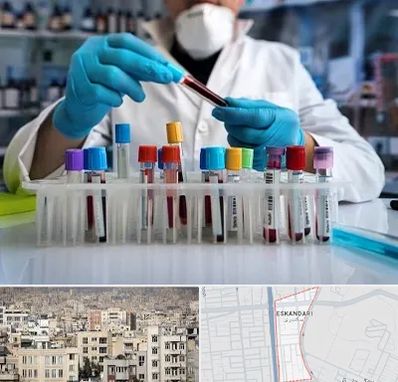 آزمایشگاه خون در اسکندری
