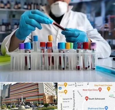 آزمایشگاه خون در سهروردی