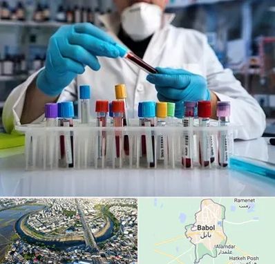 آزمایشگاه خون در بابل