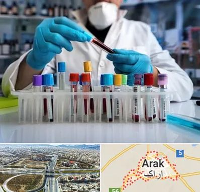 آزمایشگاه خون در اراک