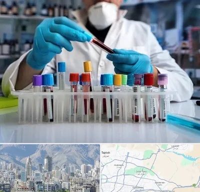آزمایشگاه خون در شمال شرق تهران