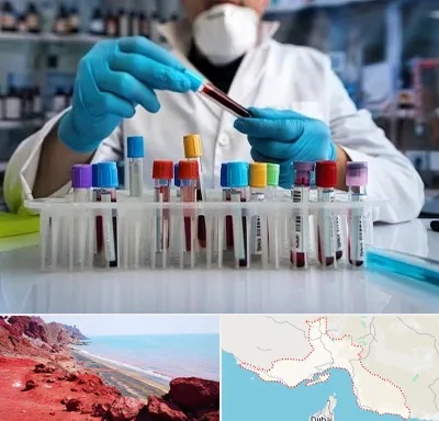آزمایشگاه خون در هرمزگان