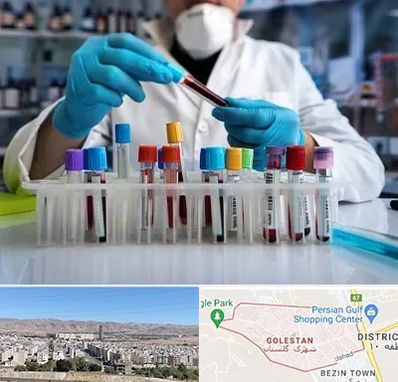 آزمایشگاه خون در شهرک گلستان شیراز