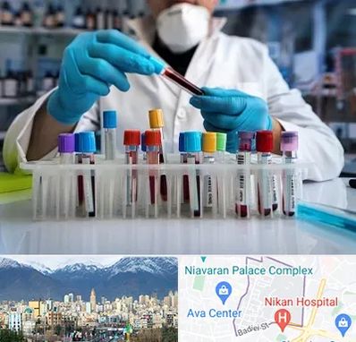 آزمایشگاه خون در آجودانیه