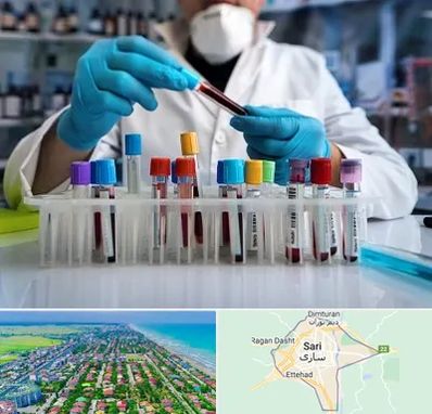 آزمایشگاه خون در ساری