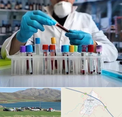 آزمایشگاه خون در دهگلان