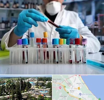 آزمایشگاه خون در رودسر