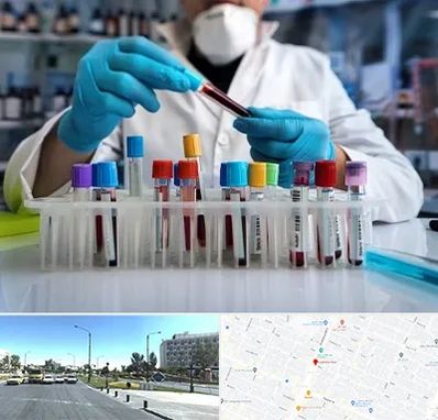 آزمایشگاه خون در بلوار کلاهدوز مشهد