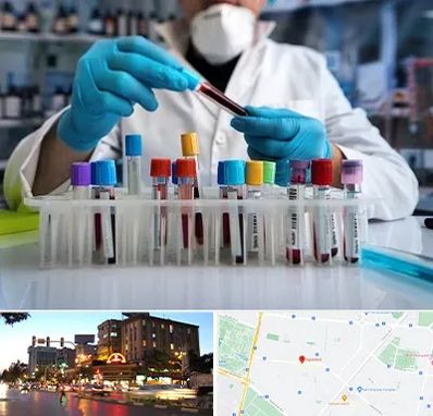 آزمایشگاه خون در بلوار سجاد مشهد